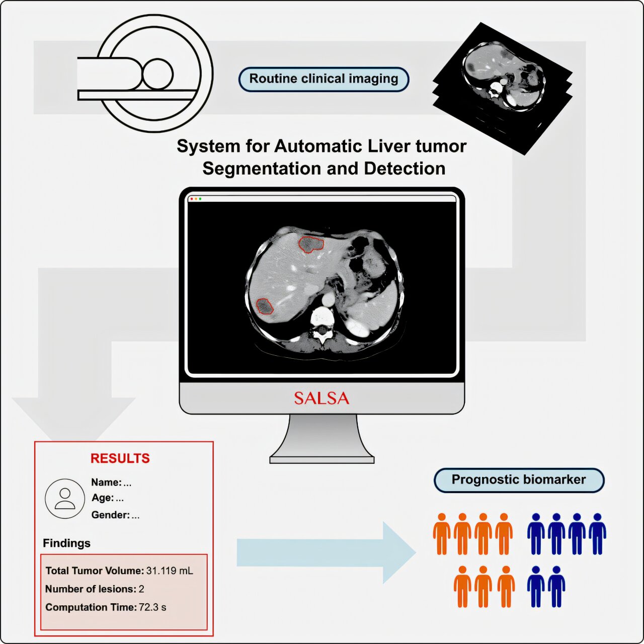 AI tool automates liver tumor detection and monitoring