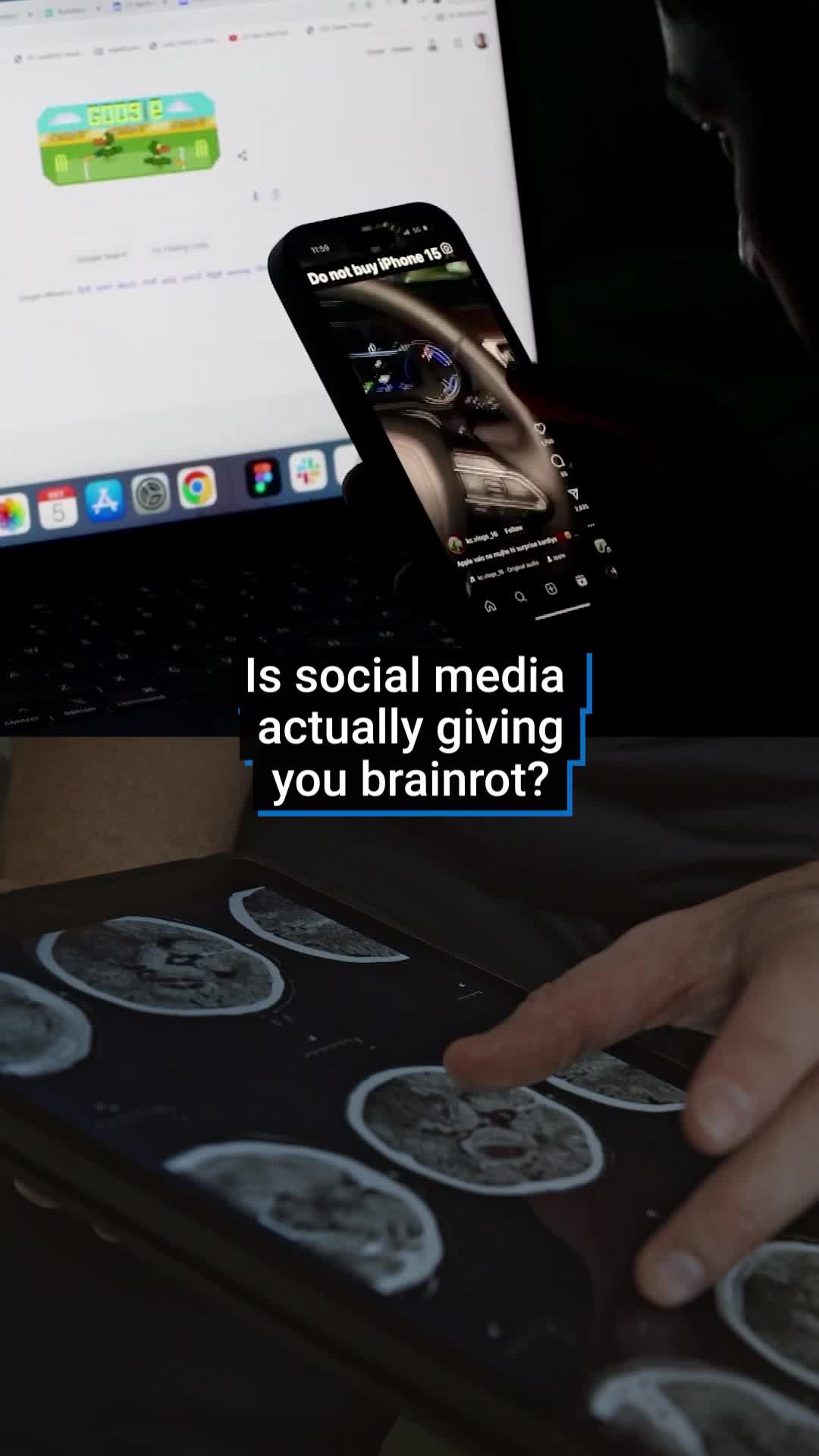 Has the internet given you brainrot? Has low-quality content reduced your mind to nothing? While the data doesn't appear to be clear on whether or not our minds are actually being melted by our phones, there is some data which shows that they do have an adverse effect on our mental health. #fyp #brainrot #mentalhealth #news #worldnews