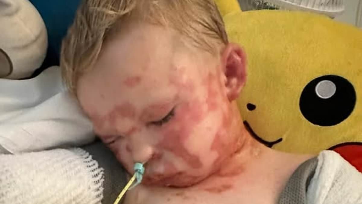Boy, four, left with horrendous facial burns after freak accident at Oklahoma children's museum