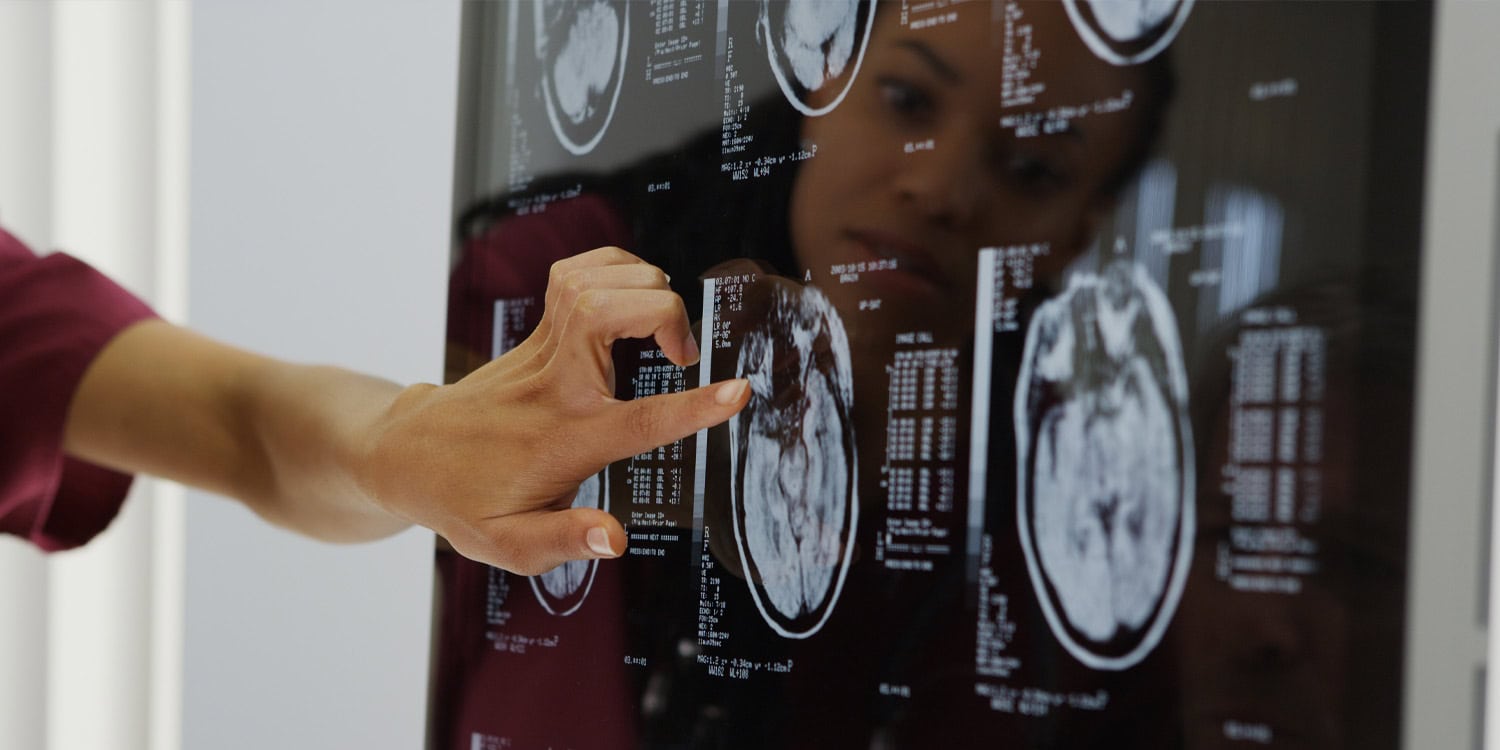 Brain injuries linked to criminal behavior highlight importance of white matter tract damage