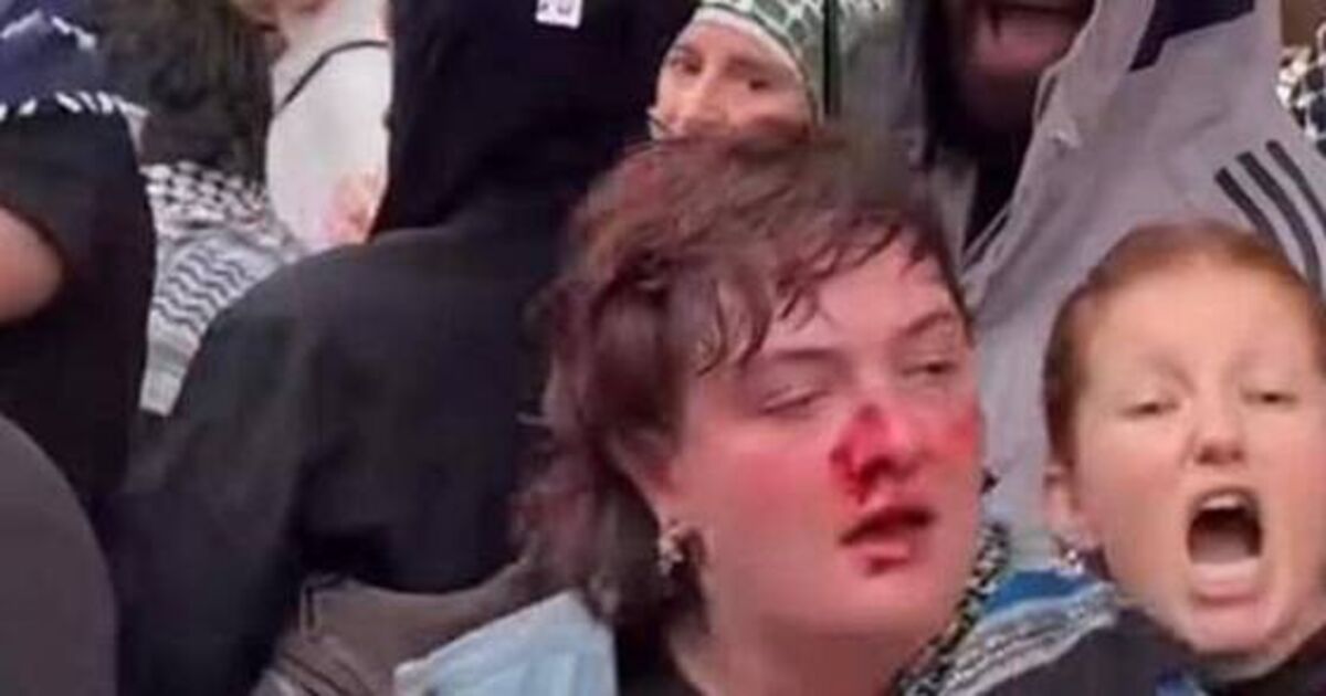 Irish protestor hospitalised after being punched by police in Berlin