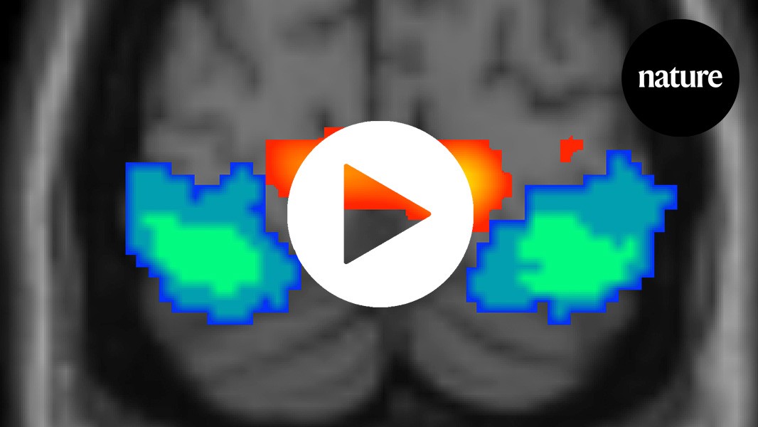 Is my red your red? Neuroscience has an answer