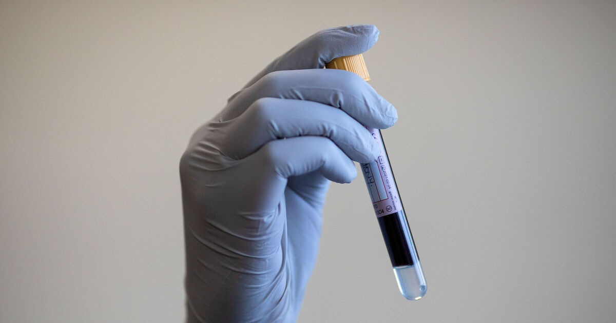 'Holy grail' blood test for more than 50 cancers delivers 'exciting' results