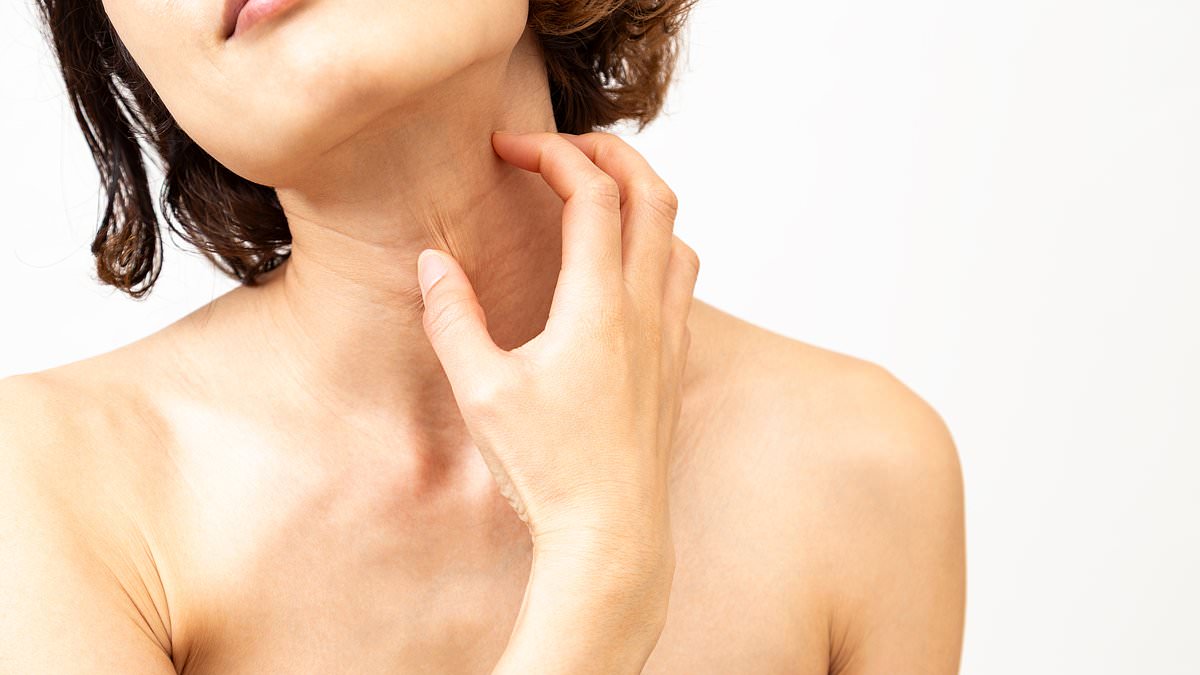 Why have I suddenly developed crusty red patches on my skin and what should I do about it? DR ELLIE has the answer