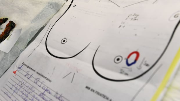 Why do pregnancy, breastfeeding reduce risk of breast cancer? Latest science finds clues