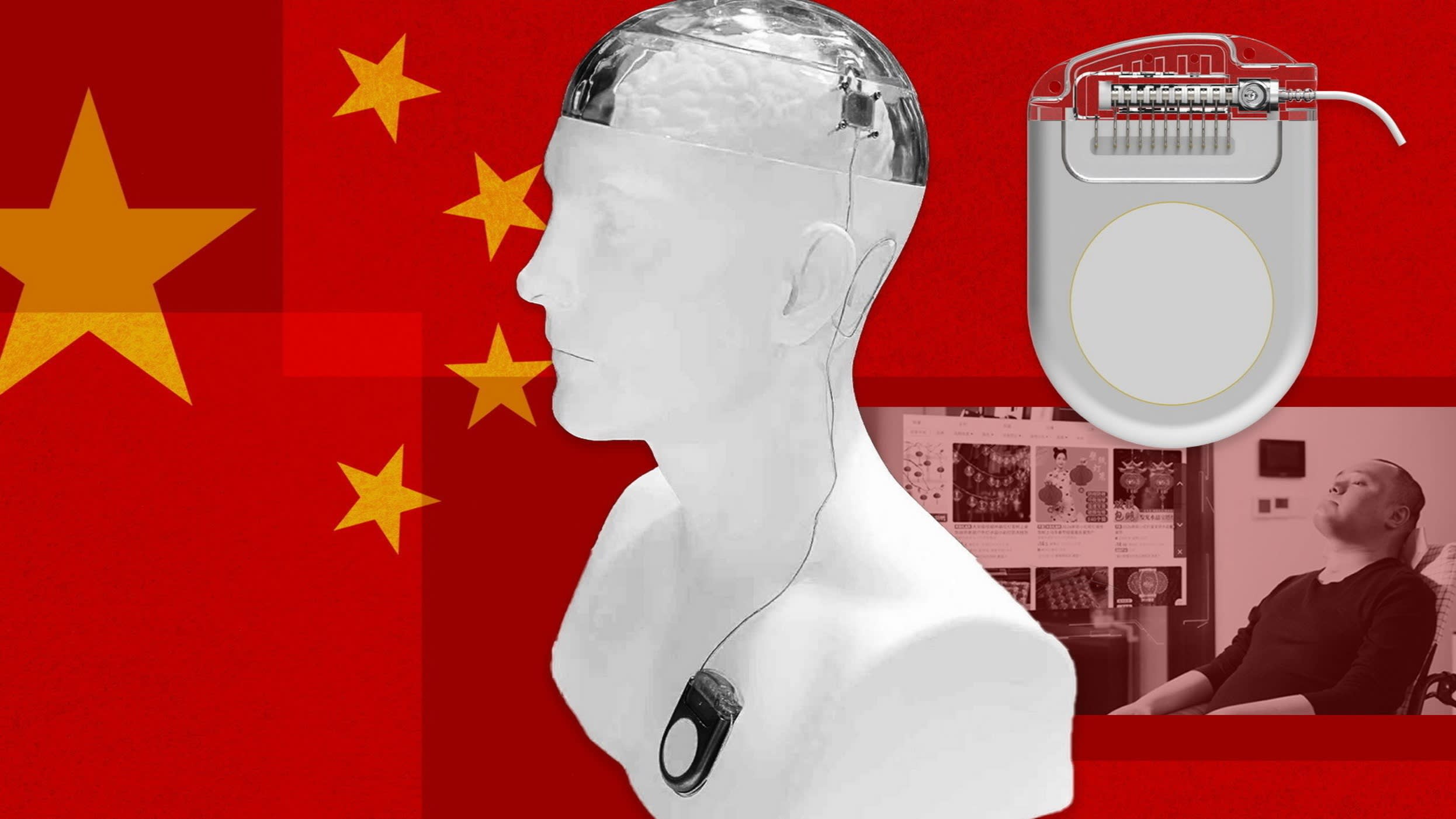 Beijing backs brain implant push to rival Elon Musk’s Neuralink
