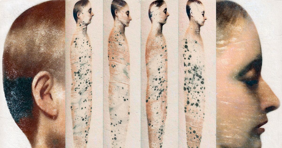 How Covid Quietly Rewires the Brain