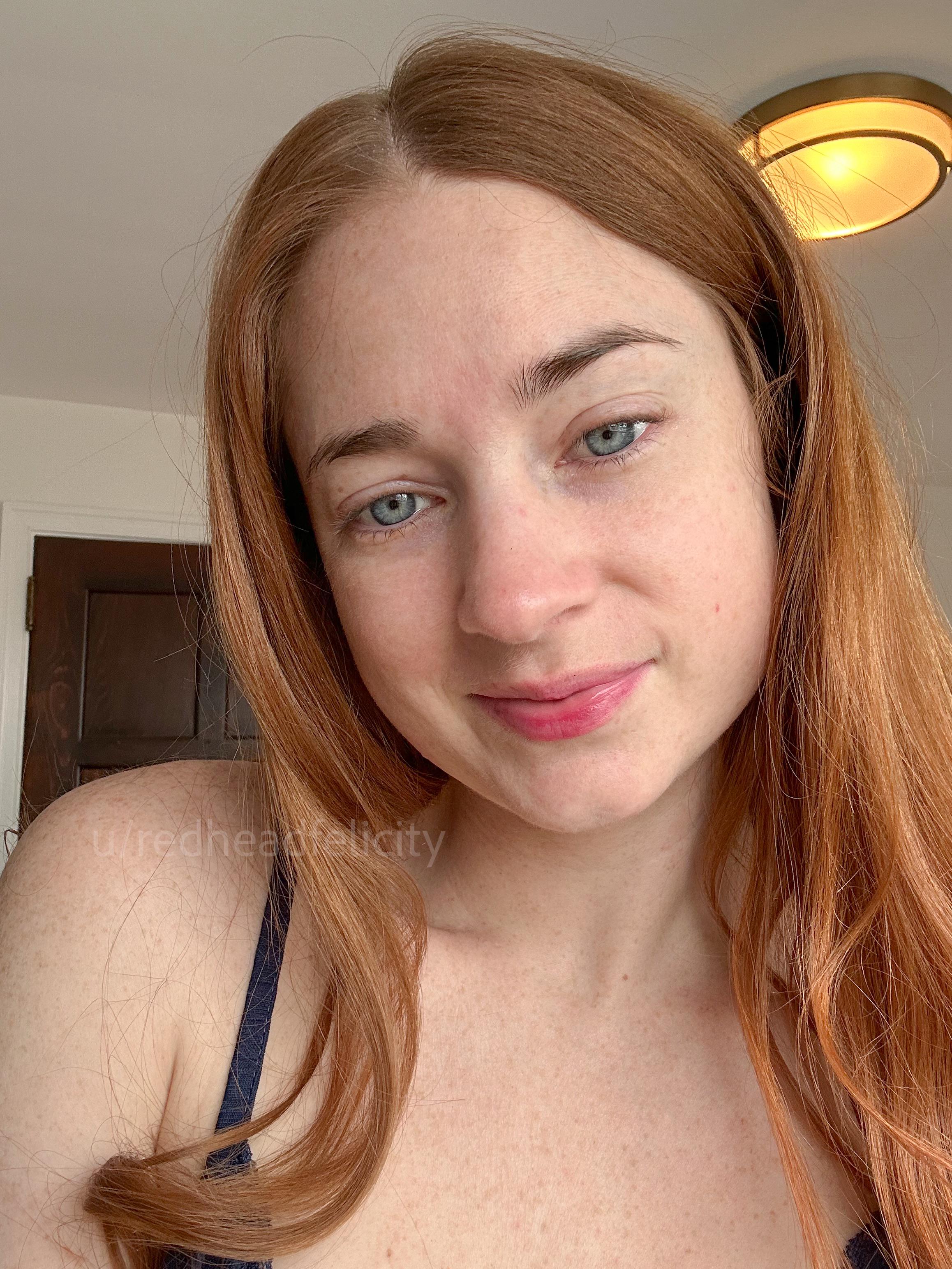 So many little freckles