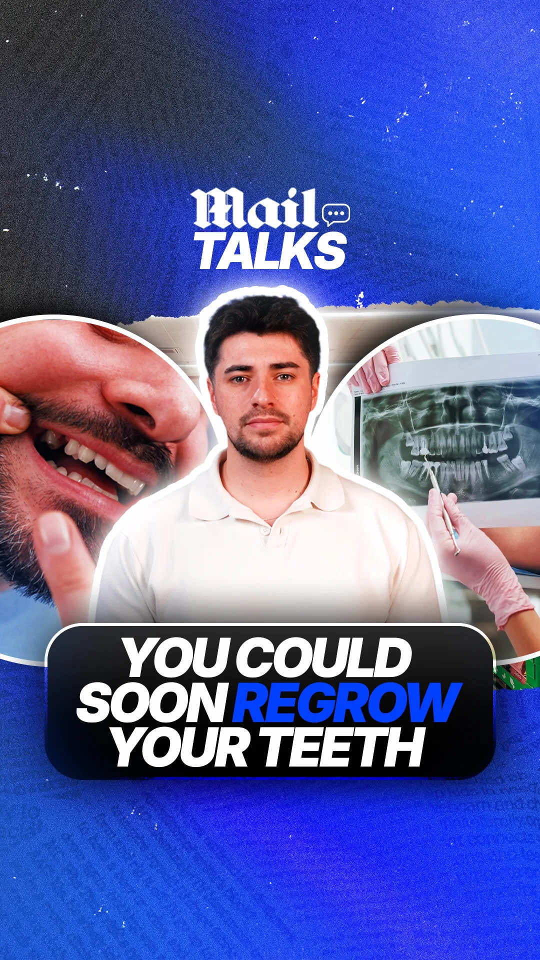 In Japan they’re testing a drug that will give you the ability to regrow lost adult teeth 🦷 🤯 #science #japan #news #wellness