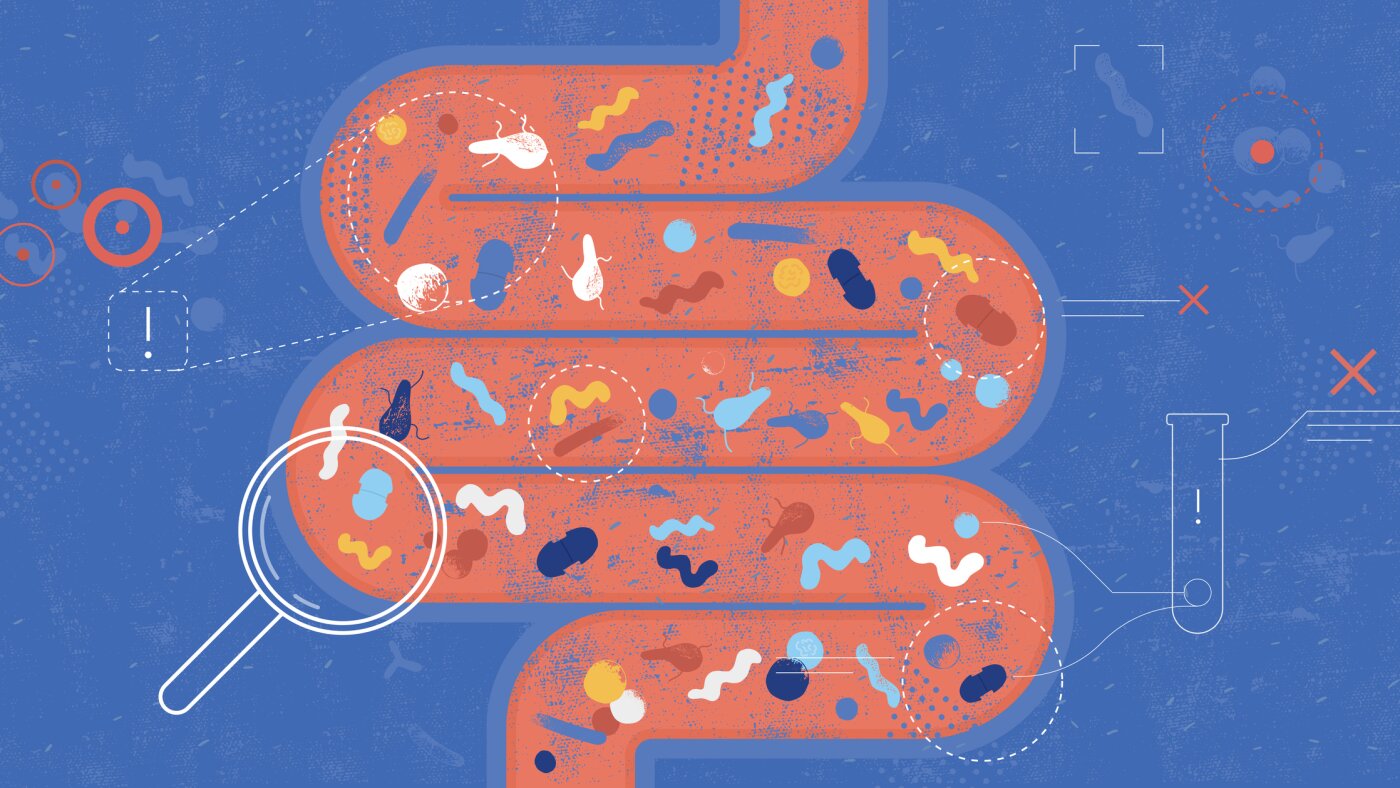 Scientists search the microbiome for clues to the rise in colorectal cancers