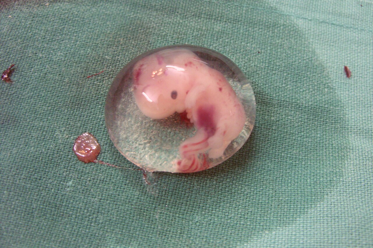 Israeli National Arrested in Cyprus for Allegedly Smuggling Embryo From an IVF Centre