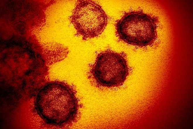 COVID-19 still kills over 30,000 a year in Japan; old people at risk | The Asahi Shimbun Asia & Japan Watch
