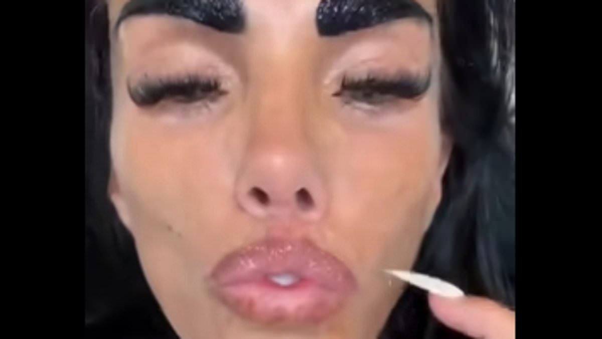 Katie Price reveals she's finally getting the bumps in her surgically enhanced lips fixed -  as she says she hates her new natural pout because it makes her Turkey teeth look 'massive'