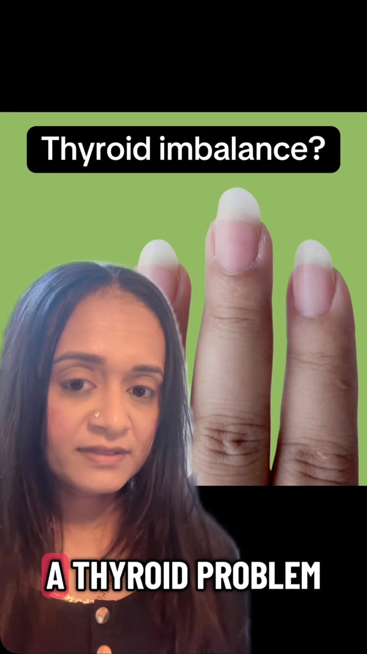 #tyroid #hormonebalance #health #body #fypppppppppppppppppppppppppppppppppppppppppppppppppppppppppppppppppppppp