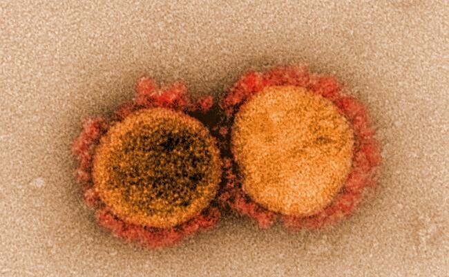 A lesser-known SARS-CoV-2 protein may offer clues to long COVID symptoms