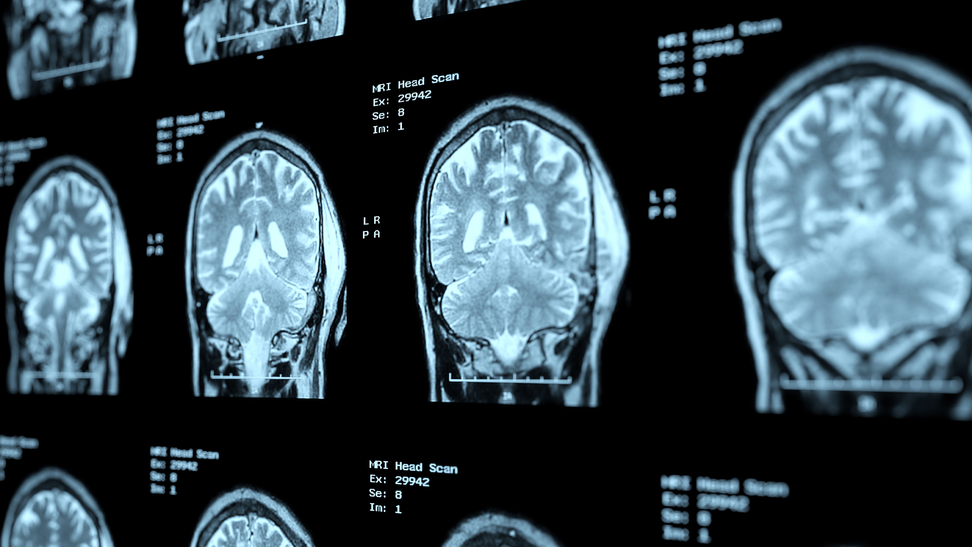 The NFL Concussion Protocol: How The League Determines If A Player Can Return To The Game