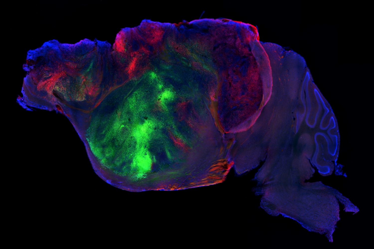 Scientists Created Mice With Half-Human Brains. The Hybrid Animals Could Revolutionize Our Understanding of Neurological Disorders
