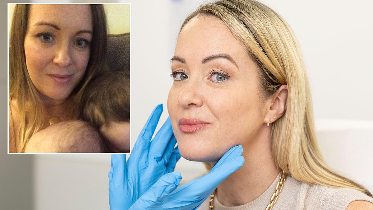 I've used my fair share of Botox but it can only really do one job... so a year ago, I decided to go a step further and find out for myself: could 'tweakments' REALLY make me look better aged 47 than I did at 37?